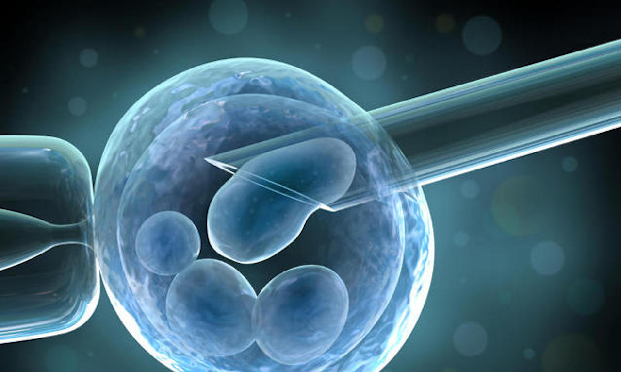 Sterilità ed endometriosi, diagnosi e cura: ne parliamo con il Dr. Giovanni Puglia